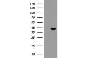 Western Blotting (WB) image for anti-Peptidylprolyl Isomerase (Cyclophilin)-Like 6 (PPIL6) antibody (ABIN1500367) (PPIL6 anticorps)