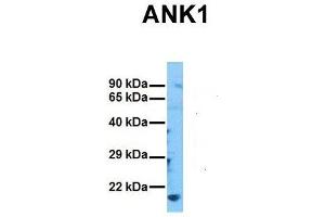 Host:  Rabbit  Target Name:  ANK1  Sample Tissue:  Human MCF7  Antibody Dilution:  1.