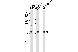 Western blot analysis of lysates from A431, THP-1 cell line and mouse spleen tissue lysate (from left to right), using SNX3 Antibody at 1:1000 at each lane. (Sorting Nexin 3 anticorps  (AA 78-105))