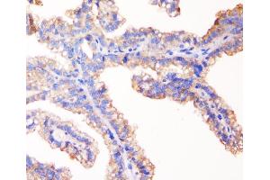 IHC analysis of TJP1 using anti-TJP1 antibody (ABIN7599787).
