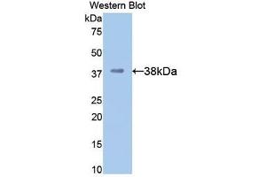Detection of Recombinant APOH, Mouse using Polyclonal Antibody to Apolipoprotein H (APOH)