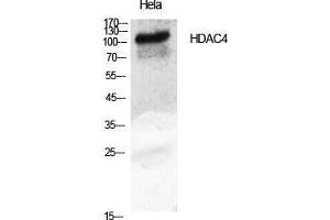 Western Blot (WB) analysis of specific cells using HDAC4 Polyclonal Antibody. (HDAC4 anticorps  (Tyr493))