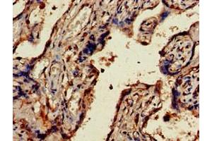 Immunohistochemistry of paraffin-embedded human placenta tissue using ABIN7174495 at dilution of 1:100