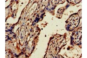Immunohistochemistry of paraffin-embedded human placenta tissue using ABIN7174495 at dilution of 1:100 (UBE2V2 anticorps  (AA 2-145))