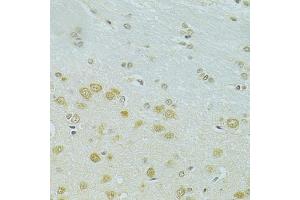 Immunohistochemistry of paraffin-embedded rat brain using RSRC1 antibody (ABIN5974341) at dilution of 1/100 (40x lens). (RSRC1 anticorps)