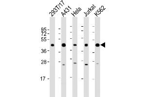 All lanes : Anti-PHF6 Antibody (C-Term) at 1:2000 dilution Lane 1: 293T/17 whole cell lysate Lane 2: A431 whole cell lysate Lane 3: Hela whole cell lysate Lane 4: Jurkat whole cell lysate Lane 5: K562 whole cell lysate Lysates/proteins at 20 μg per lane. (PHF6 anticorps  (AA 315-349))