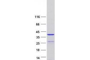 Validation with Western Blot
