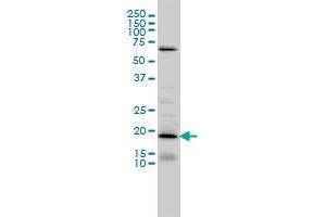 D4S234E monoclonal antibody (M01), clone 1C3 Western Blot analysis of D4S234E expression in IMR-32 . (NSG1 anticorps  (AA 1-185))