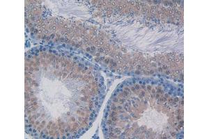 Used in DAB staining on fromalin fixed paraffin- embedded testis tissue