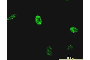 Immunofluorescence of monoclonal antibody to NKX2-5 on HeLa cell.
