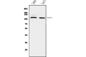 Western blot analysis of ERAP2 using anti-ERAP2 antibody (ABIN7599949).