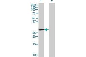 Lane 1: KIRREL2 transfected lysate ( 23. (KIRREL2 293T Cell Transient Overexpression Lysate(Denatured))