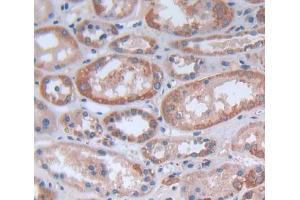 IHC-P analysis of kidney tissue, with DAB staining. (FASTK anticorps  (AA 330-524))