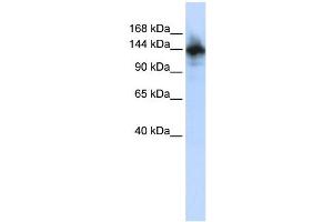 WB Suggested Anti-RBM6 Antibody Titration: 0. (RBM6 anticorps  (N-Term))