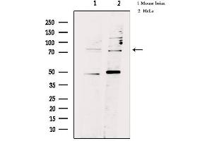 Western blot analysis of extracts from various samples, using FSHR Antibody. (FSHR anticorps  (Internal Region))