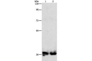 Western Blot analysis of Mouse kidney and Human fetal kidney tissue using ASPA Polyclonal Antibody at dilution of 1:1400 (ASPA anticorps)