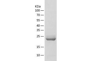 Western Blotting (WB) image for Adenylate Kinase 4 (AK4) (AA 1-223) protein (His-IF2DI Tag) (ABIN7121720)