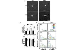 MVs induce morphological changes in epithelial cells cultured in 3D (A) Phase contrast images at 0 h and 24 h of MCF10a cells supplemented with MVs (+MVs) or culture media alone (Ctrl).