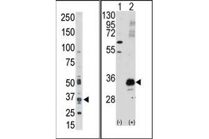 Image no. 1 for anti-Pim-1 Oncogene (PIM1) (C-Term) antibody (ABIN360327) (PIM1 anticorps  (C-Term))