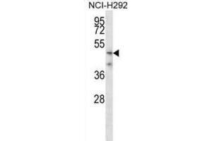 Western Blotting (WB) image for anti-Transmembrane Protease, serine 5 (TMPRSS5) antibody (ABIN2998262) (TMPRSS5 anticorps)