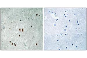 Immunohistochemical analysis of paraffin-embedded human brain tissue using CNOT2 (Phospho-Ser101) antibody (left)or the same antibody preincubated with blocking peptide (right). (CNOT2 anticorps  (pSer101))