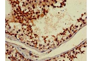 Immunohistochemistry of paraffin-embedded human testis tissue using ABIN7142928 at dilution of 1:100 (ABI2 anticorps  (AA 164-452))