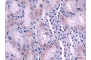 DAB staining on IHC-P; Samples: Rat Kidney Tissue