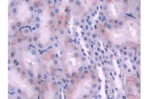 DAB staining on IHC-P; Samples: Rat Kidney Tissue (NDRG2 anticorps  (AA 2-300))