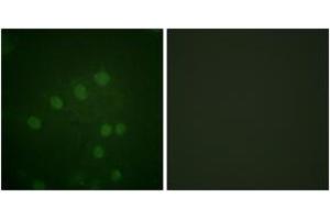 Immunofluorescence analysis of HepG2 cells, using AurB (Phospho-Thr232) Antibody. (Aurora Kinase B anticorps  (pThr232))