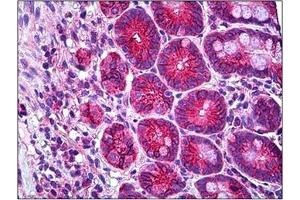 Human Small Intestine: Formalin-Fixed, Paraffin-Embedded (FFPE)