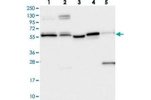 Western blot analysis of Lane 1: RT-4, Lane 2: U-251 MG, Lane 3: Human Plasma, Lane 4: Liver, Lane 5: Tonsil with PPRC1 polyclonal antibody  at 1:250-1:500 dilution.