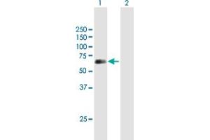 Western Blot analysis of SPINT1 expression in transfected 293T cell line by SPINT1 MaxPab polyclonal antibody.