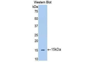 Western Blotting (WB) image for anti-Interleukin 13 Receptor, alpha 2 (IL13RA2) (AA 238-334) antibody (ABIN1174865) (IL13RA2 anticorps  (AA 238-334))