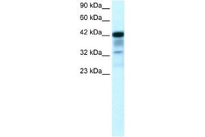 WB Suggested Anti-POU2F3 Antibody Titration:  0. (POU2F3 anticorps  (N-Term))