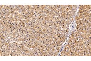 Detection of IGF1 in Porcine Liver Tissue using Polyclonal Antibody to Insulin Like Growth Factor 1 (IGF1) (IGF1 anticorps  (AA 49-118))