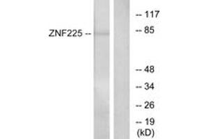 Western Blotting (WB) image for anti-Zinc Finger Protein 225 (ZNF225) (AA 641-690) antibody (ABIN2889802) (ZNF225 anticorps  (AA 641-690))