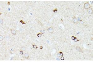Immunohistochemistry of paraffin-embedded Rat brain using CCDC6 Polyclonal Antibody at dilution of 1:100 (40x lens). (CCDC6 anticorps)