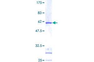 Image no. 1 for Isopentenyl-Diphosphate delta Isomerase 1 (IDI1) (AA 1-228) protein (GST tag) (ABIN1307381)