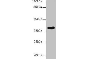 Western blot All lanes: CAB39L antibody at 10 μg/mL + 293T whole cell lysate Secondary Goat polyclonal to rabbit IgG at 1/10000 dilution Predicted band size: 40 kDa Observed band size: 40 kDa (CAB39L anticorps  (AA 1-270))