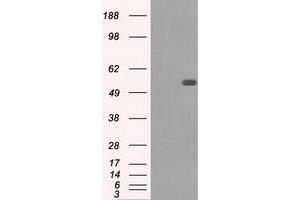 HEK293T cells were transfected with the pCMV6-ENTRY control (Left lane) or pCMV6-ENTRY FH (Right lane) cDNA for 48 hrs and lysed. (FH anticorps)