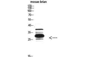 Western Blot (WB) analysis of Mouse Brain using IGFBP3 Polyclonal Antibody diluted at 1:800.