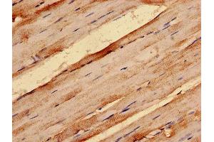 IHC analysis of paraffin-embedded human skeletal muscle tissue, using G0S2 antibody (1/100 dilution). (G0S2 anticorps  (AA 1-103))