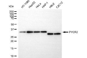 Western blotting analysis using PYCR2 antibody (ABIN7800079).