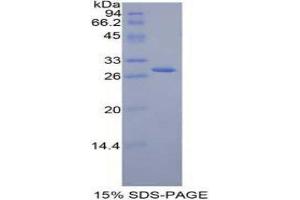 SDS-PAGE (SDS) image for Jagged 2 (JAG2) (AA 709-941) protein (His tag) (ABIN2125516)
