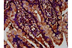 anti-Adhesion G Protein-Coupled Receptor G1 (ADGRG1) (AA 26-216) antibody