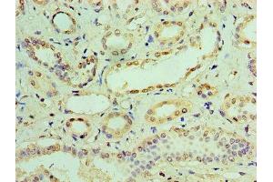 Immunohistochemistry of paraffin-embedded human kidney tissue using ABIN7156671 at dilution of 1:100 (IFIT3 anticorps  (AA 1-490))