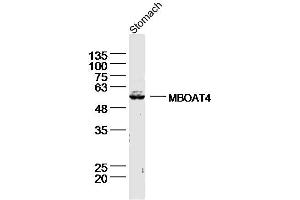 Lane 1: Mouse stomach lysates probed with Ghrelin O acyltransferase Antibody, Unconjugated (bs-13355R) at 1:300 overnight at 4˚C. (MBOAT4 anticorps  (AA 101-200))