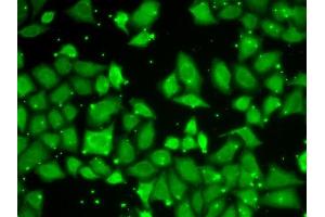 Immunofluorescence analysis of U2OS cells using MLST8 antibody (ABIN6131371, ABIN6143894, ABIN6143895 and ABIN6217660). (GBL anticorps  (AA 1-326))