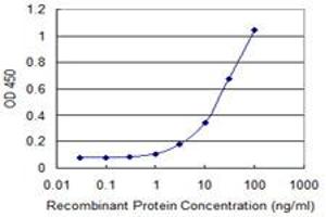 Detection limit for recombinant GST tagged FOXM1 is 0. (FOXM1 anticorps  (AA 22-110))
