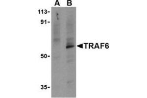Western blot analysis of TRAF6 in PC-3 cell lysates with this product at 1 μg/ml in the presence (A) or absence (B) of 1 μg blocking peptide.
